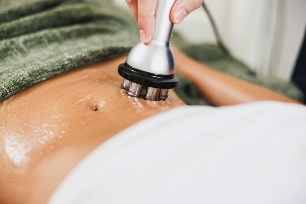 RF Body Treatment in Toronto